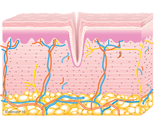 Skin Tightening Graphic of Untreated Skin